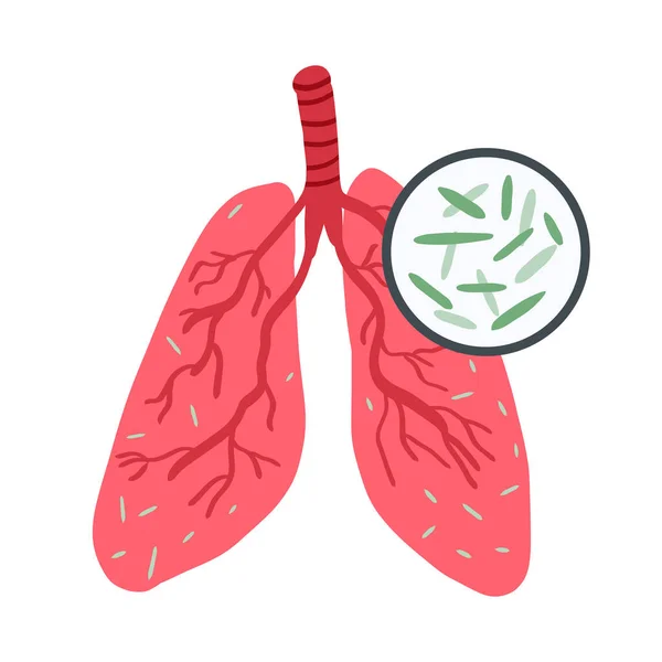 세계 결핵 절 현수막. 인간 폐는 결핵 바실루스에 감염되어 있다. 건강 관리, 질병 예방 개념 — 스톡 벡터