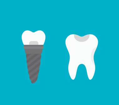 diş implantı vektör çizimi