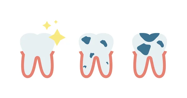 벡터 치통, 충치 및 건강한 치아 개념. — 스톡 벡터