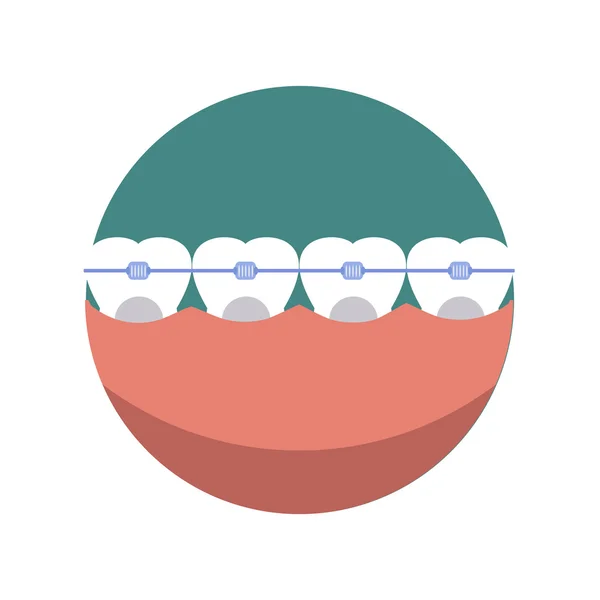 Tanden Tandheelkundige mond zorvuldig bretels vector. — Stockvector