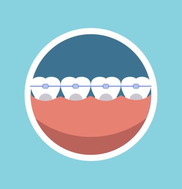 Tooth braces vector illustration