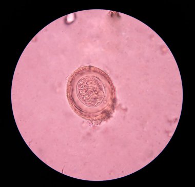 parazit yumurta dışkı sınavı.