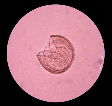 parazit yumurta dışkı sınavı.