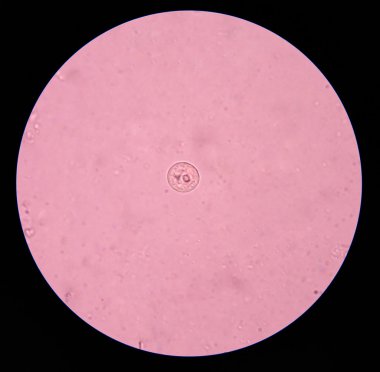 entamoeba coli cyts potozoa dışkı sınavı.