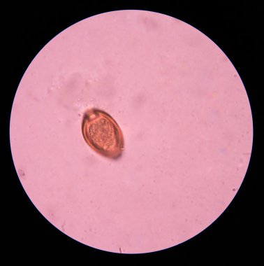 parazit yumurta dışkı sınavı.