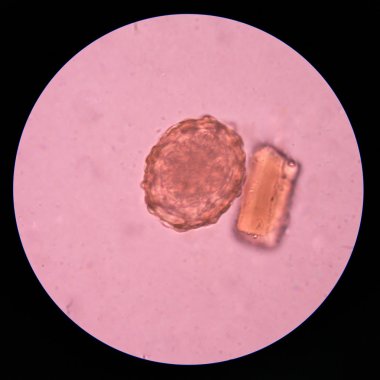 parasite egg in stool exam. clipart