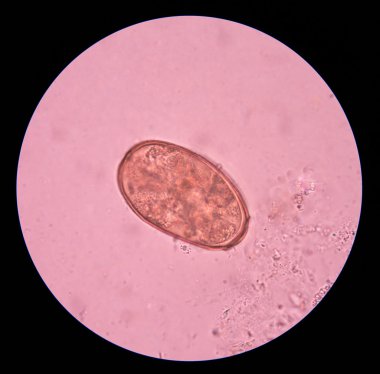 parazit yumurta dışkı sınavı.