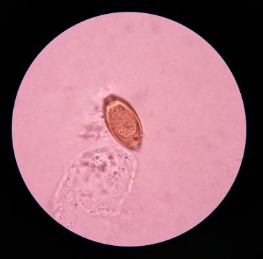 parazit yumurta dışkı sınavı.