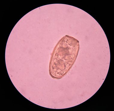 parazit yumurta dışkı sınavı.