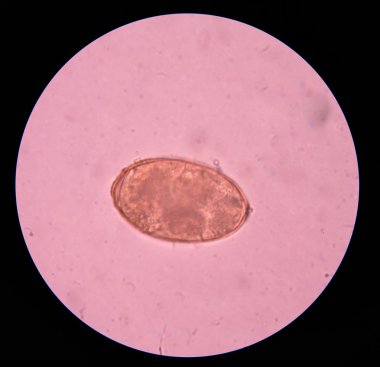 parazit yumurta dışkı sınavı.