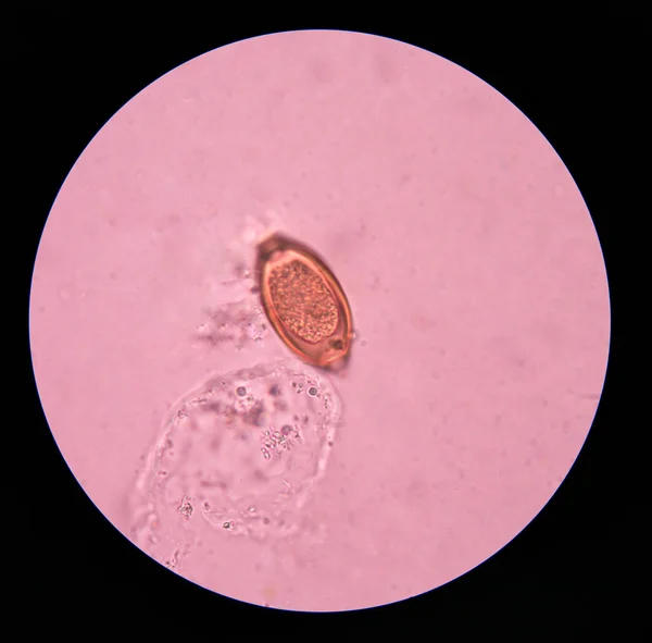 Huevo parásito en el examen de heces . —  Fotos de Stock