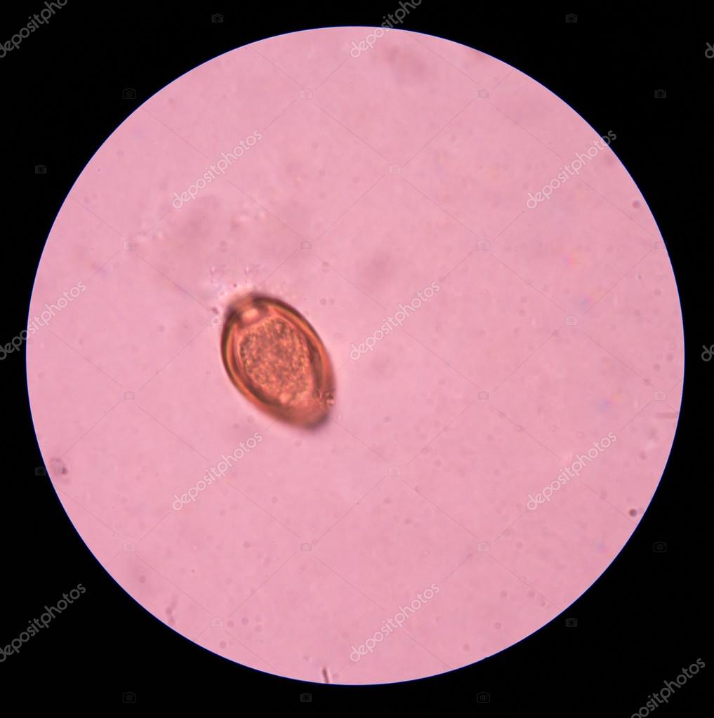 List 103+ Wallpaper Parasite Eggs In Human Stool Pictures Stunning 12/2023