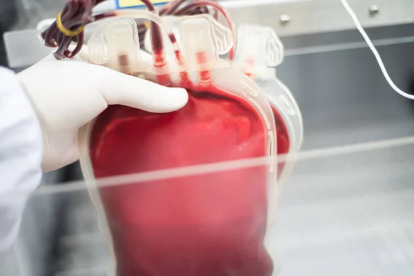 Bloedkoudeketen Een Systeem Voor Opslag Het Transport Van Bloed Bloedproducten — Stockfoto