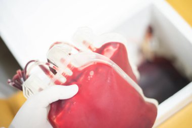 Örnek yaşam için kan torbası. Kan bankası laboratuvarı..