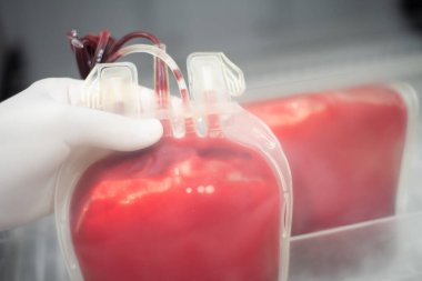 Örnek yaşam için kan torbası. Kan bankası laboratuvarı..