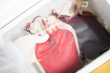 Örnek yaşam için kan torbası. Kan bankası laboratuvarı..