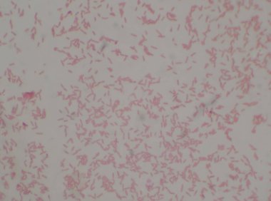 Gram negatif bakteri ve bipolar leke bakterisi. Burkholderia pseudomalle.Tıbbi arka plan.