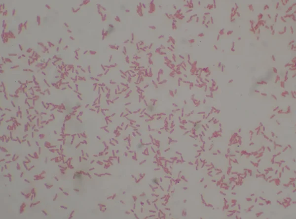 Bacilos Gramnegativos Con Bacterias Tinción Bipolares Burkholderia Pseudomallei Medical Scince — Foto de Stock