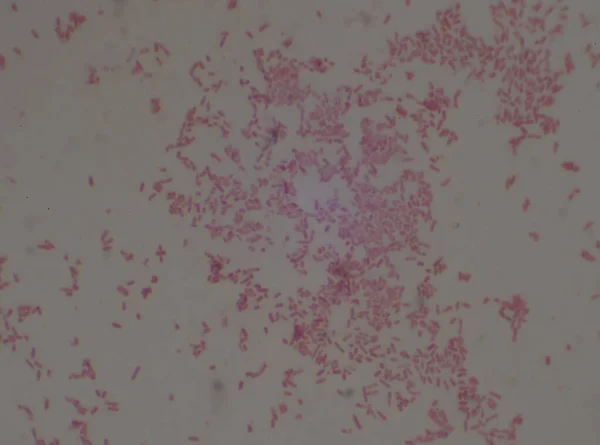 Bacilli Gram Negativo Con Batterio Macchia Bipolare Burkholderia Pseudomallei Medical — Foto Stock