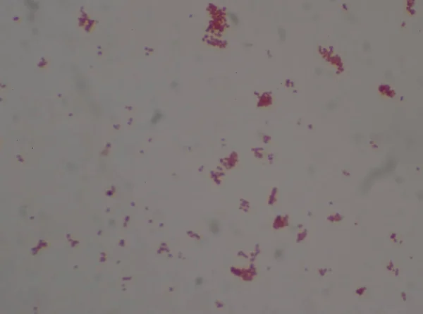 Gram Negative Diplococi Bakterier Neisseria Spp Medicinsk Scince Baggrund - Stock-foto
