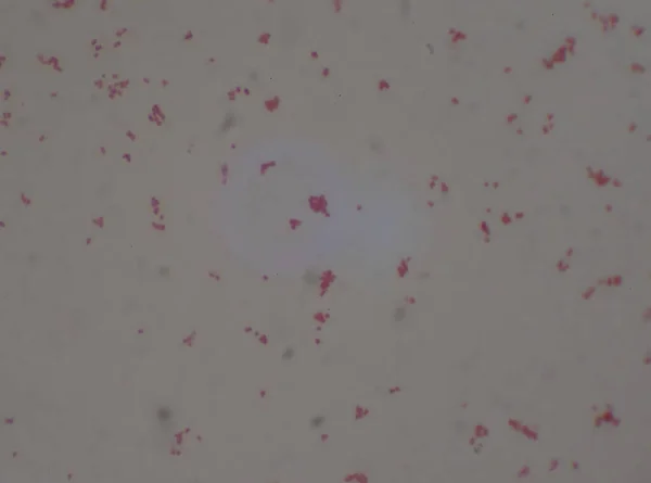 Gram Negativi Diplococi Batteri Neisseria Spp Medical Sfondo Cotogna — Foto Stock