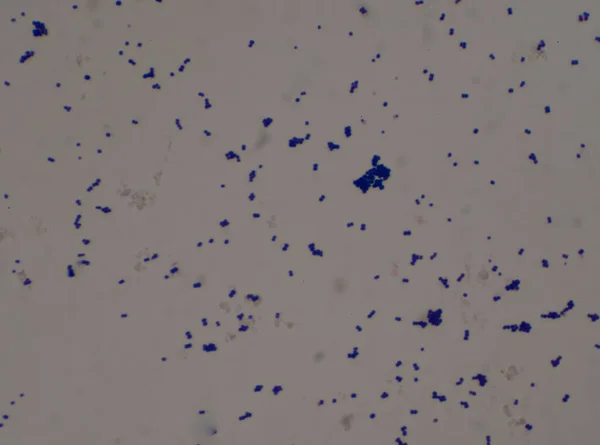Gram Boyası Gram Pozitif Cocci Staphylococus Aureus — Stok fotoğraf