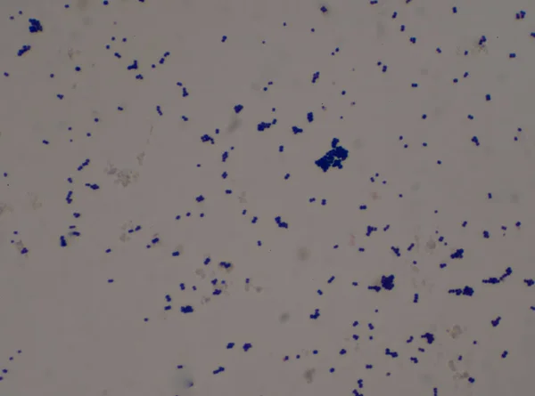 Gram Stain Gram Θετικοί Κόκκοι Staphylococus Aureus — Φωτογραφία Αρχείου