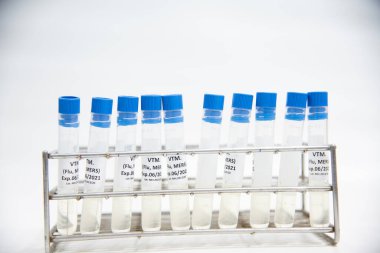 Bilim adamı ve mavi eldivenli viral ulaşım aracı (VTM) örnek koleksiyonu Covid-19.