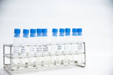 Bilim adamı ve mavi eldivenli viral ulaşım aracı (VTM) örnek koleksiyonu Covid-19.