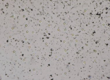 Cryptococcus neoformans kapsüllü bir mantar organizmasıdır ve görünüşe göre bağışıklık sistemi yetmezliğinin yanı sıra bağışıklık sistemine de zarar verebilir..