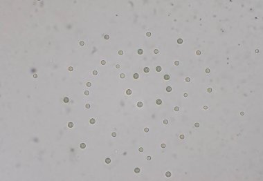 Cryptococcus neoformans kapsüllü bir mantar organizmasıdır ve görünüşe göre bağışıklık sistemi yetmezliğinin yanı sıra bağışıklık sistemine de zarar verebilir..