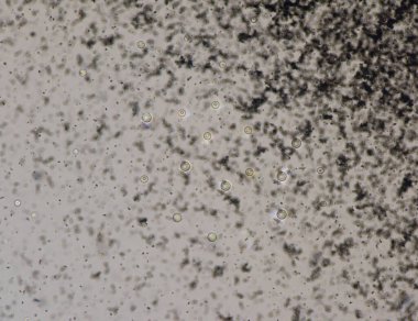 Cryptococcus neoformans kapsüllü bir mantar organizmasıdır ve görünüşe göre bağışıklık sistemi yetmezliğinin yanı sıra bağışıklık sistemine de zarar verebilir..