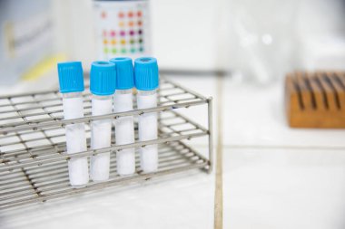 Mavi arkaplanda laboratuvar testinde test tüpü.