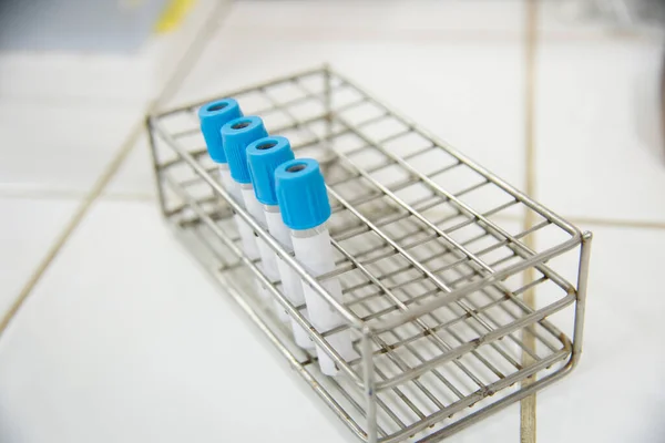 Test tube in laboratory testing on blue background.