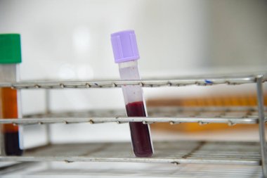 Mavi arkaplanda laboratuvar testinde test tüpü.