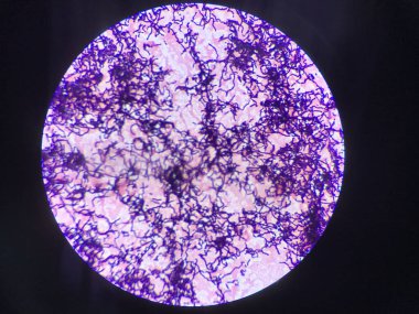 Gram lekesindeki bakteri hücreleri.