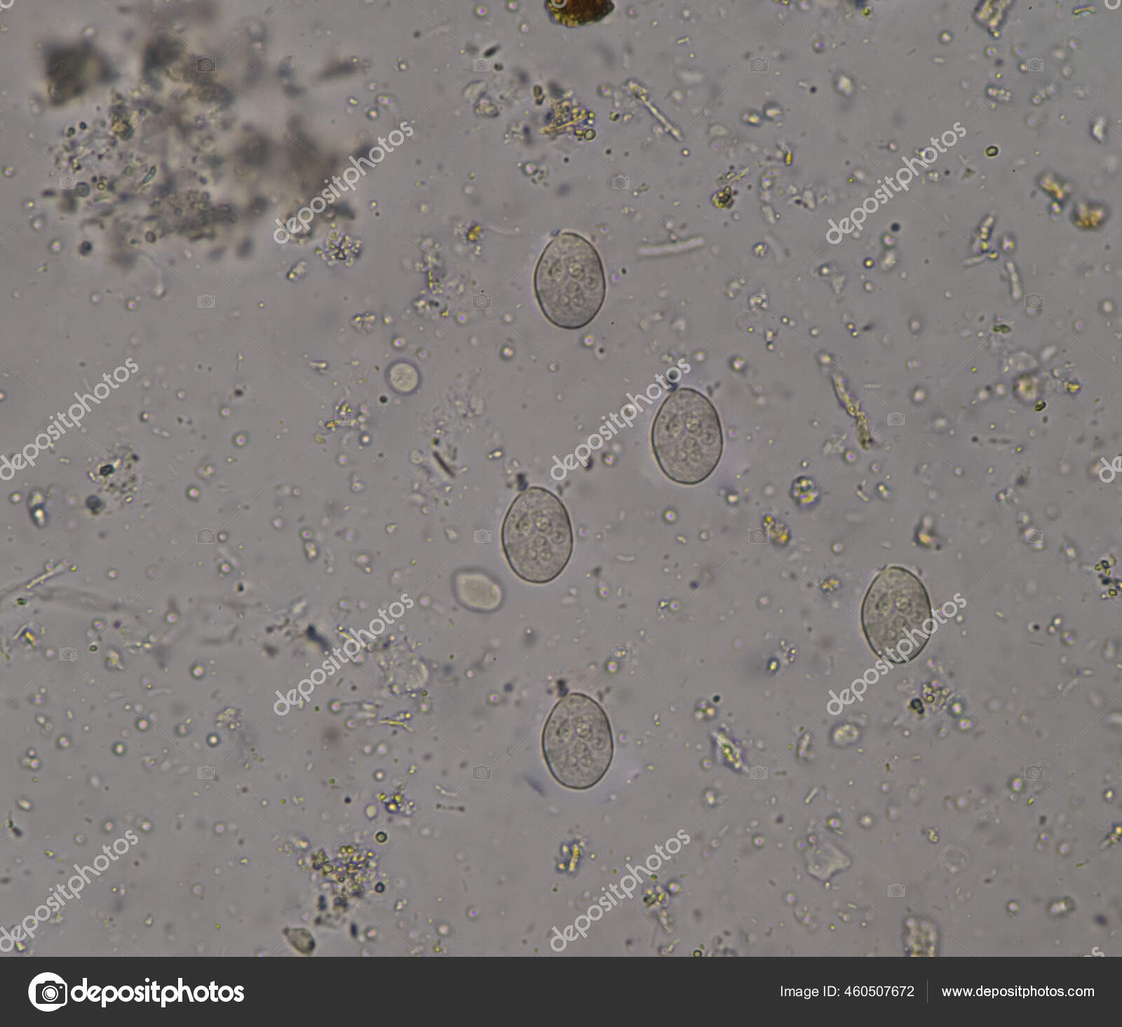 Protozao Entamoeba Histolytica Cyte Stage Stool Examination Stock Photo