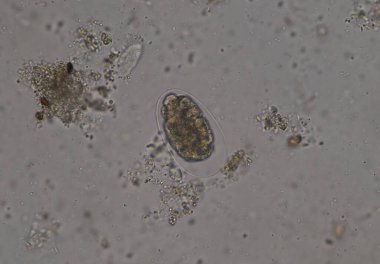 Dışkı muayenesinde pasazitin kanca kurdu yumurtaları..