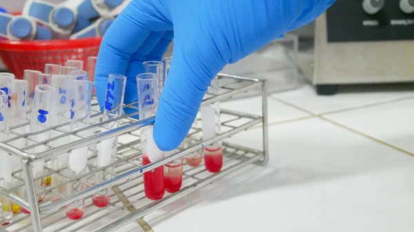 Наукове Тестування Перехресного Язку Лабораторії Банку Крові — стокове фото