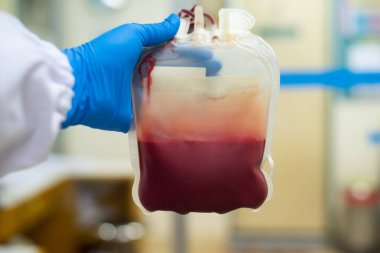 Kan torbası donör konsepti olan mavi eldivenli bir el bilimcisi..