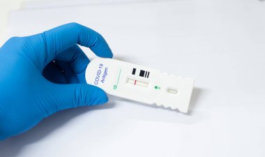 Strip Tarama Hızlı Test COVID-19 antijen negatif. Biyolojik Dolap Sınıfı 3 'te test ediliyor..