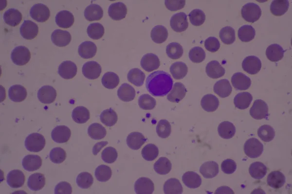 Adequate Platelet Blood Smear Compleat Blood Count — Stock Photo, Image