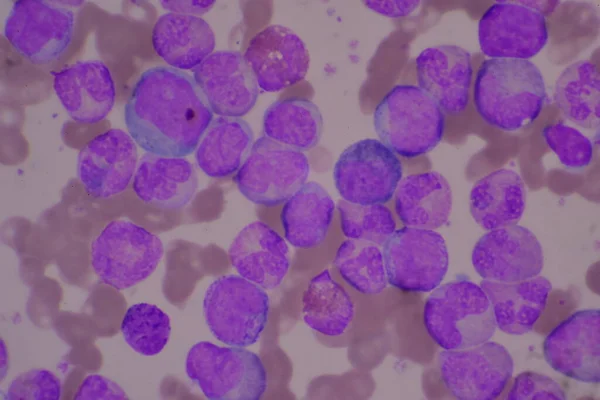 Immature Mature White Blood Cells Segmented Neutrophil Blast Cells Myelocyte — Stock Photo, Image