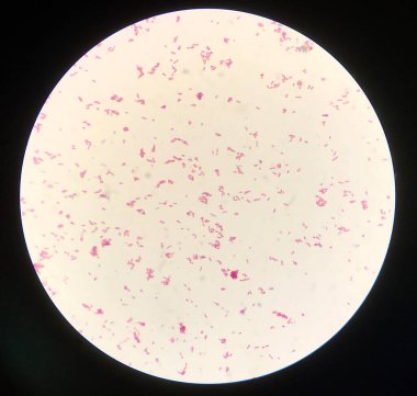 Gram lekesinde bakteri hücresi.