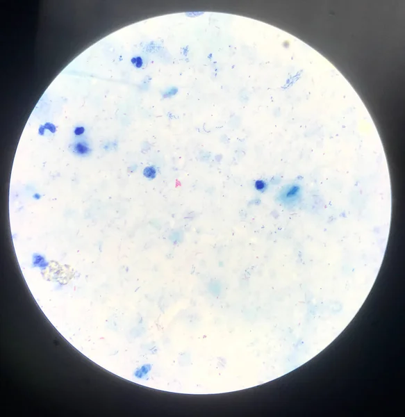 Bakterieceller Vid Gramfärgning — Stockfoto