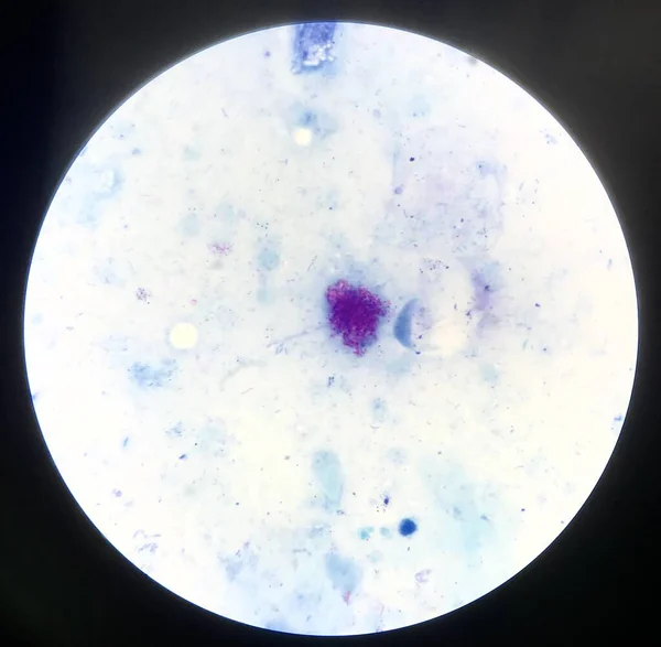 Bakterienzellen Gramm Fleck — Stockfoto