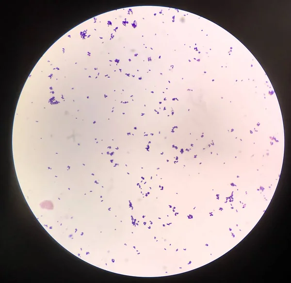 Célula Bacteriana Coloração Gram — Fotografia de Stock