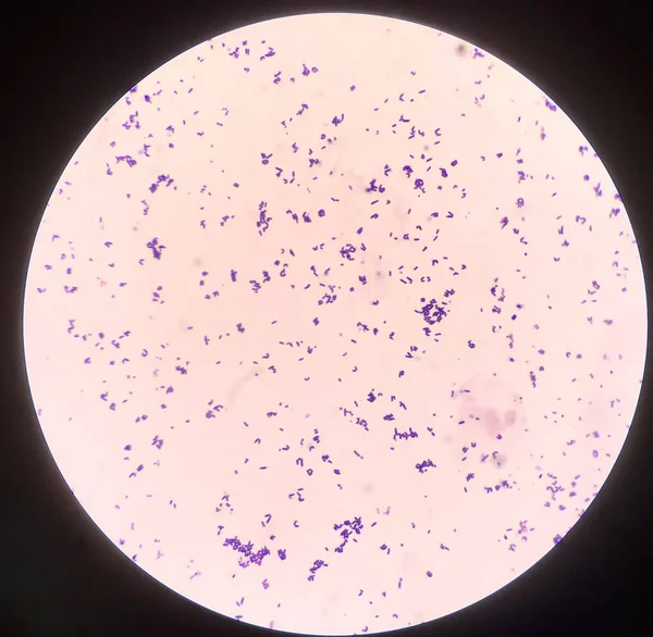 Célula Bacteriana Coloração Gram — Fotografia de Stock