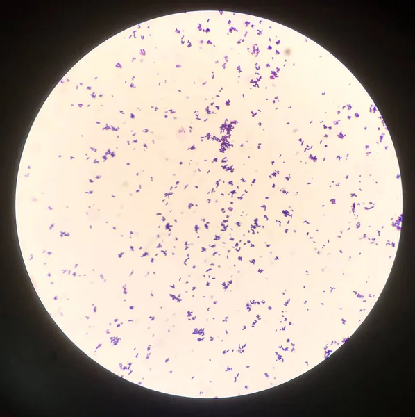 Célula Bacteriana Tinción Gram — Foto de Stock