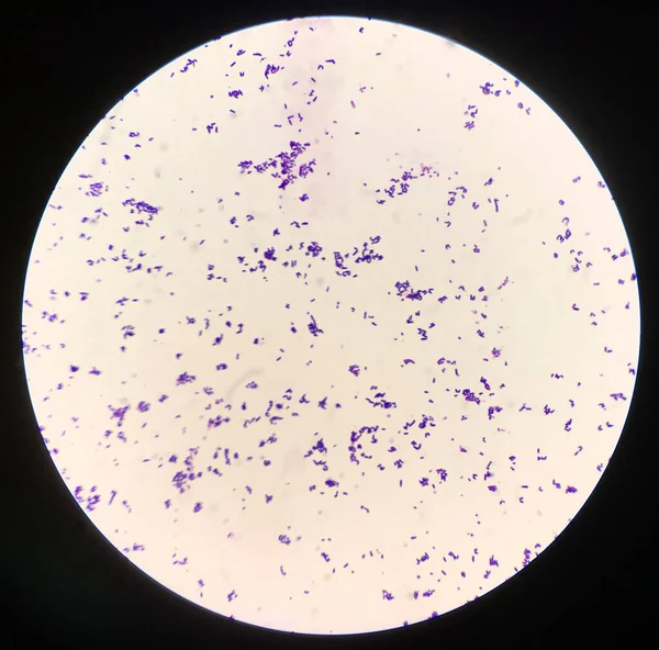 Célula Bacteriana Tinción Gram — Foto de Stock